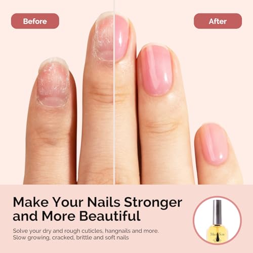 Image of MelodySusie No Wipe Glossy Top Coat Base Coat Cuticle Oil Set Long Lasting Shine Finish Soak Off UV LED Nail Lamp Nail Art Design Manicure Kit Perfect Gifts for Women Girls 3 Pcs 15ml