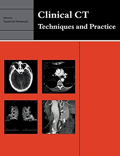 Clinical CT view 2