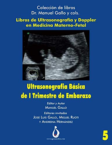 Ultrasonografia Basica de I Trimestre de Embarazo