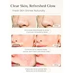 Rena Chris 3 Pcs Silicone Face Scrubber, 3 in 1 Face Mask Applicator & Facial Cleansing Brush, Pore Brush for Exfoliating, Blackhead, Skincare Applicator Tools - Image 4