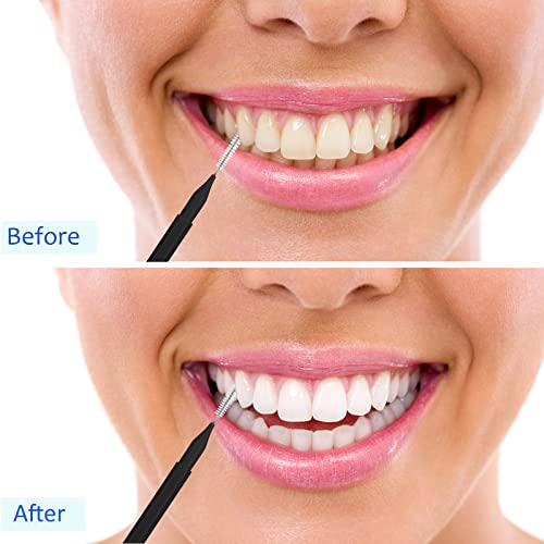 Image of Patelai 100 Pcs Braces Dental Brushes,Black,Elegant Size | Interdental Toothpick Bristle Dental Picks for Cleaner Tooth Flossing Head Oral Hygiene Flosser Toothpick Cleaners Tooth Tool