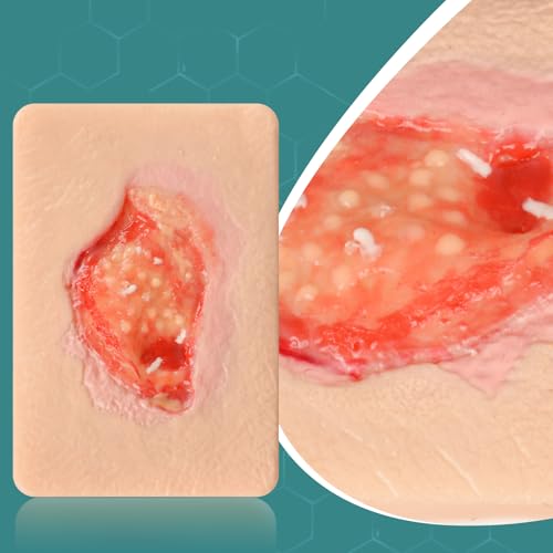 Image of Unhealthy Granulation Wound Simulation Models for Medical Education