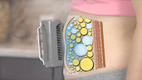 The Ultimate Shape-N-Freeze Body Sculpting Fat Freezer System