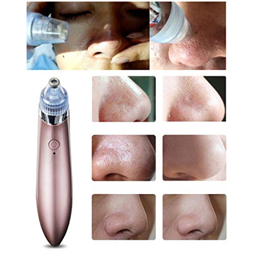 Aisence Removedor de cravos elétrico, sucção a vácuo