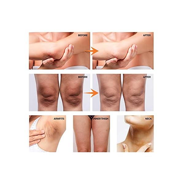 Natural-Vine-Underarm-Cream-Dark-Spot-Cream-Instant-Result-Brighten-Moisturizes-Armpit-Neck-Knees-Private-Parts60ML Natural Vine Underarm Cream, Dark Spot Cream, Instant Result, Moisturizes Armpit, Neck, Knees, Private Parts