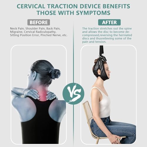 Image of Neck Stretcher Cervical Traction Device for Home Use - Over The Door Cervical Neck Traction Device for Decompression Home Physical Therapy, Portable Neck Traction Device for Neck Pain (Black)