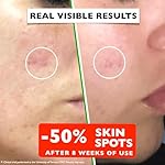 Vitamin C Serum For Face – Anti-Aging Facial Serum with Vitamin C, Hyaluronic Acid, Niacinamide, B5 & Vit E. Brightening Facial Essence for Dark Spots, Fine Lines, Wrinkles & Glowing Skin, 2 Fl Oz - Image 4