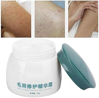 Professional Keratosis Pilaris Cream Body Soothing Chicken Skin Treatment Body Care Cream for Home & Travel 50g