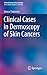 Produktbild Clinical Cases in Dermoscopy of Skin Cancers (Clinical Cases in Dermatology)