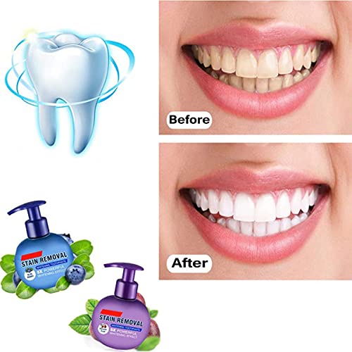 2 Pcs Baking Soda Whitening Toothpaste, Instant Brightify Natural Toothpaste Passion Fruit Blueberry Press Baking Soda… - Image 7