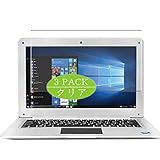 VacFun Lot de 3 Clair Film de Protection d'écran, Compatible avec Lava Helium 12 12inch, Film Protecteur sans Bulles(Non vitre Verre trempé) VacFun Lot de 3 Clair Film de Protection d'écran, Compatible avec Lava Helium 12 12inch, Film Protecteur sans Bulles(Non vitre Verre trempé)