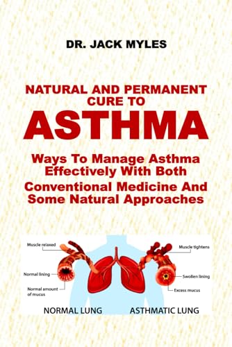 NATURAL AND PERMANENT CURE TO ASTHMA: Ways To Manage Asthma Effectively With Both Conventional Medicine And Some Natural Approaches