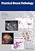 Practical Breast Pathology