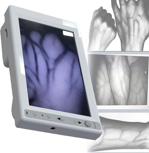 Dispositivo portatile per flebotomia, strumento di visualizzazione delle vene ricaricabile per accesso IV, strumento essenziale per infermieri e professionisti medici
