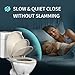 Round Toilet Seat Almond, Toilet Lid 16.5 inch with Soft Close, No Slam,Easy Installation & Release for Bottom Fixing Toilet，Safe PP Material Easy Clean，2 Years Support,B2B Available,Almond
