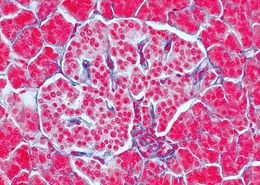 Endocrine System - English Microscope Slides/ Set of 50