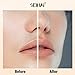 SEIHAI Facial Hair Remover for Women, Rechargeable Face Shavers for Women,Included 2 x Replacement Heads, Upper Lip, Chin, Face Hair Remover Peach Fuzz Remover