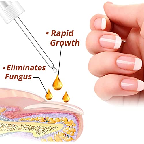Gfouk 7 Days Nail Growth And Strengthening Serum, Nail Growth And Strength Serum, Nail Serum Repair Essence, Nail Cuticle Oil Strengthener, Stronger Nails In 1 Week Nail Strengthening Treatment (2Pc) #TOP3