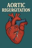 Aortic Regurgitation: Pathophysiology, Diagnosis, and Management : offers a comprehensive exploration of one of the most complex and often underestimated valvular heart diseases.