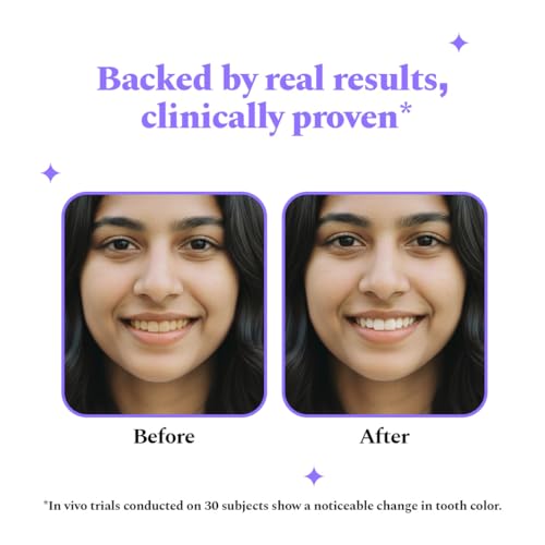 Image of Perfora Purple Teeth Whitening Strips - Pack of 7 Treatments (14 Strips) - Whitens Teeth in 1 Use | Peroxide & Sensitivity-Free, Enamel-Safe Oral Care | PAP & Hydroxyapatite For Stain Removal | Self-dissolving Strips