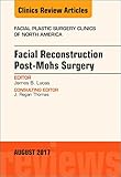  Facial Reconstruction Post-Mohs Surgery, An Issue of Facial Plastic Surgery Clinics of North America, 1e: Volume 25-3 (The Clinics: Surgery)