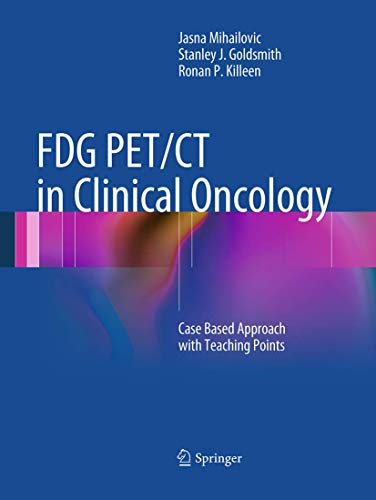 Télécharger FDG PET/CT in Clinical Oncology: Case Based Approach with Teaching Points Gratuit