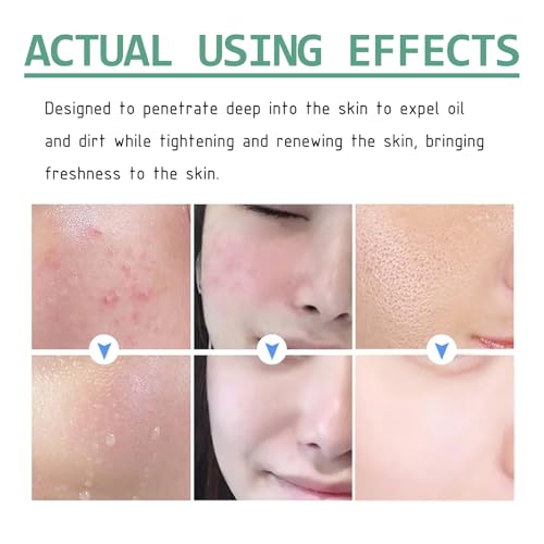 Máscara de Té Verde, Mascarilla Limpiadora Facial, Green Tea Deep Cleanser Mask, Mascarilla de Arcilla de té Verde, Hidratar Piel, Mejora La Sequedad de La Piel, Adecuado Para Todo Tipo De Pieles - imagen 3