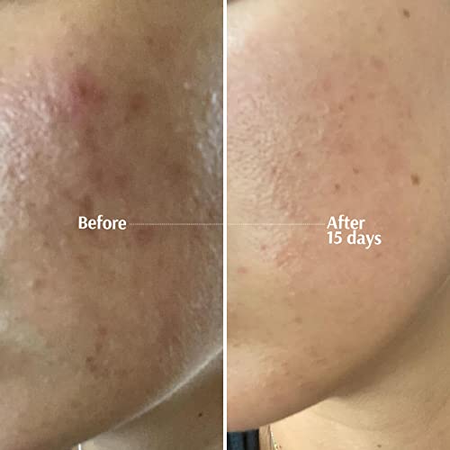 Tara Radiance Vitamin C Complex Serum. Cruelty-Free: Protect, Brighten And Tighten Skin With 4 Types Of Vitamin C, Hyaluronic And Ferulic Acids. Free From Parabens, Sulfates And Mineral Oils (1.7 Fl Oz) #TOP6