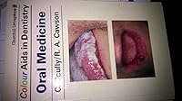 Oral Medicine 0443038759 Book Cover
