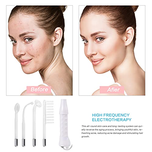 Aravli High Frequency Facial Wand, Portable Handheld Electrode High Frequency Beauty Tool Machine for Acne, Spot, Wrinkles Remover Skin Tightening Beauty Therapy Device for... - Image 6
