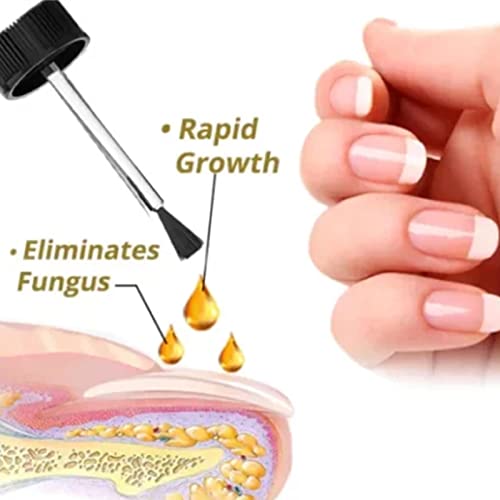 Nailgro Intense Nail Growth And Strengthening Serum - Natural Nail Repair Essence Serum, Nail Repair Solution For Damaged And Discolored Nails, Strengthens And Nourishes Nails (5Pcs) #TOP1