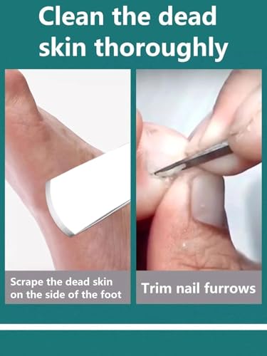 Image of Piercell Pedicure Knife Set | Dead Skin Corn Foot Callus Remover Kit | Personal Care Tool & Accessories | For Ingrown Toenail File /Lifter | Foot Repair Tools With Sharp Blade | Foot Scraper (Set of 1)