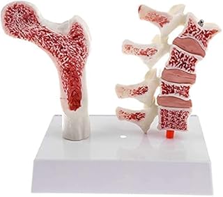 Study Model Educational Model Human Bone Anatomy Model 1: 1 Lifsize Human Lumbar Vertebrae and Femur Osteoporosis Skeletal Pathology Model SaiFei