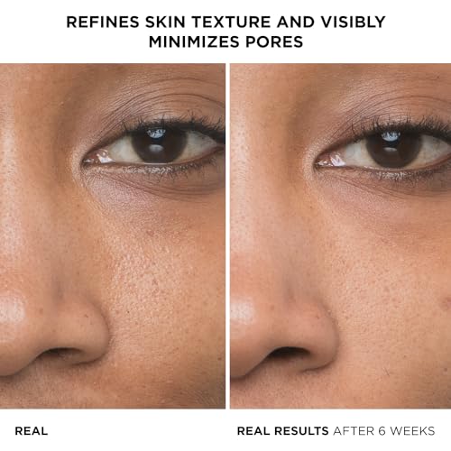 image for IT Cosmetics Bye Pores 10% Glycolic Acid Serum - Visibly Minimizes In 