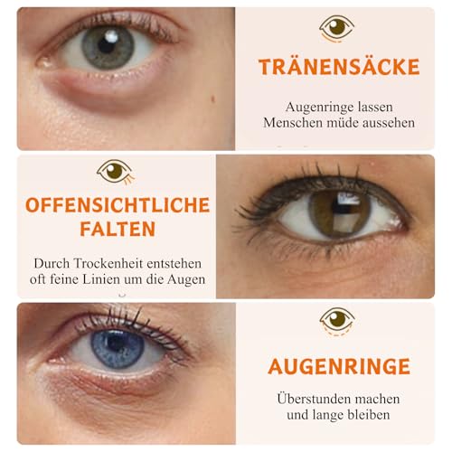 60 Stück Vitamin C Augenpads, VC Augenpads gegen Augenringe & Tränensäcke, Augenringe Entfernen, Anti Aging Eye Pads mit Kollagen & Hyaluron, Eye Mask für Männer & Frauen, Feuchtigkeit Augenpflege
