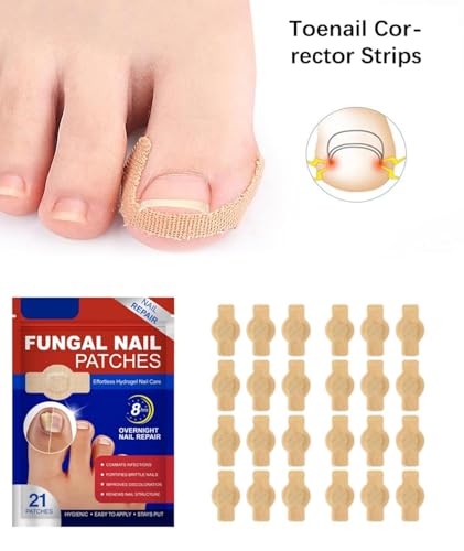 Image of Advanced Fungal Nail Patch Treatment (20 PATCH) Powerful Antifungal Solution | Targets Nail Fungus at the Root | Easy-to-Use Patch for Toenail & Fingernail