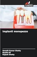 Impianti monopezzo (Italian Edition) 6203890081 Book Cover