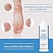 ForPro Professional Collection Premium Callus No More! Callus Remover, Fast-Acting Callus Removing Formula, 32 oz.