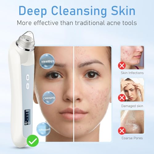 Image of Facial Pore Blackhead Remover Vacuum, 1080P Camera Blackhead Remover, 20x Zoom, 8 LEDs & 3 Suction Modes, 800mAh Battery & USB - 6 Heads Pore Cleaner Kit for Women&Men(White)