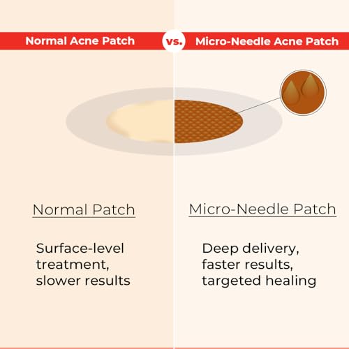 Image of bbold Microneedle Pimple Patches for face salicylic acid | Pimple Remover Acne Patch with Hyaluronic Acid Fights Acne from the Root & Reduces Acne Scarring - 45 Patches (Pack of 5)