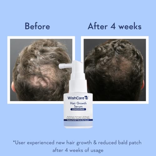 Image of WishCare Hair Growth Serum Concentrate - Resdensyl, Anagain, Caffeine, Biotin, Keratin & Rice Water 20ml