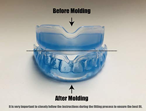 Coollo Sports Boil And Bite Mouth Guard Bb Custom Fit Sport Mouthpiece For Basketball thumb #1