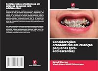 Considerações ortodônticas em crianças pequenas (pré-adolescentes) (Portuguese Edition) 6207818660 Book Cover