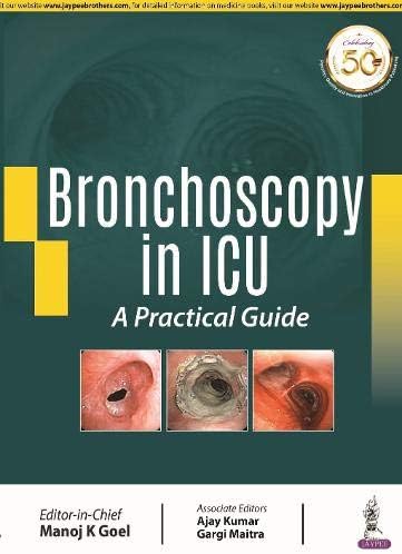 Bronchoscopy in ICU: A Practical Guide