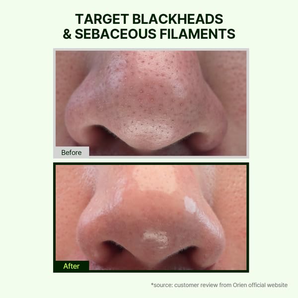 Mugwort Zero Film Cleansing Oil 6.76 fl.oz. 200ml ㅣDaily Makeup Blackhead Removal No pore clogging Korean skincare double cleansing image 2 of 7 B0F9YPY1L4