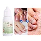 Se puede usar para resolver todo tipo de problemas con las uñas, suavizar la consistencia de las uñas y restaurar la salud.