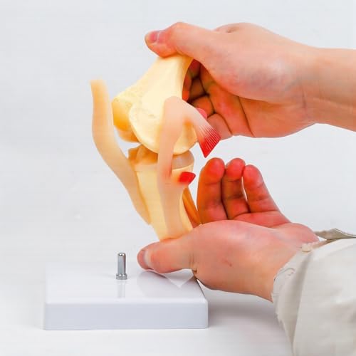 Modelo anatómico de rótula de rodilla: la solución visual para explicar lesiones ligamentosas 6