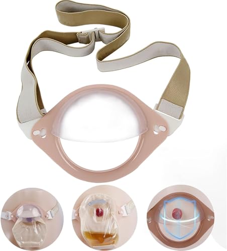 ストーマガード、ストーマシャーシ補強、セキュリティシールド、女性と男性のための人工肛門バッグカバーの保護