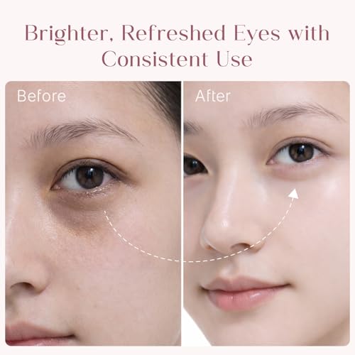Image of Seoulskin under eye cream | dark circles removal for women and men | Under Eye Gel to Reduce Dark Circles, Puffiness & Wrinkles With Built-in Cooling Massage Roll-On Applicator | 5% Niacinamide, 2% Alpha Arbutin | 15 ml
