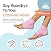 ZenToes Moisturizing Socks for Cracked Heel Treatment, Vitamin E, Olive Oil and Jojoba Oil Infused Heel Socks, Spa Gifts for Women, Relaxation Gifts for Women (Fuzzy Pink, Regular)